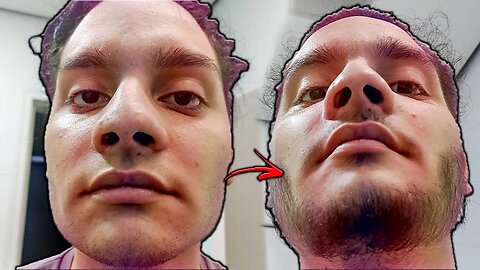 DEIXANDO A BARBA CRESCER DEPOIS DE RASPAR✅️ | USANDO MINOXIDIL KIRKLAND🔥
