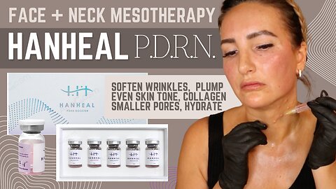HANAHEAL PDRN Skin Booster // Acecosm.com // BEAUTYLAB10