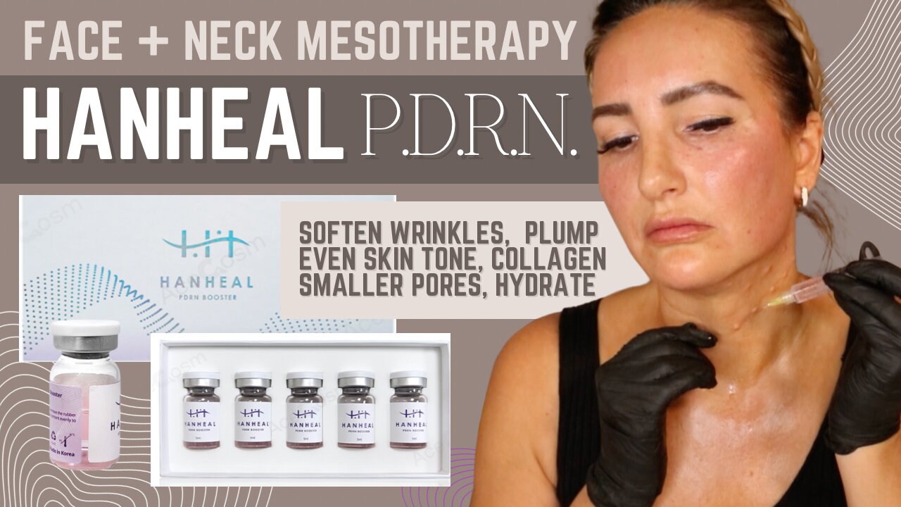 HANAHEAL PDRN Skin Booster // Acecosm.com // BEAUTYLAB10