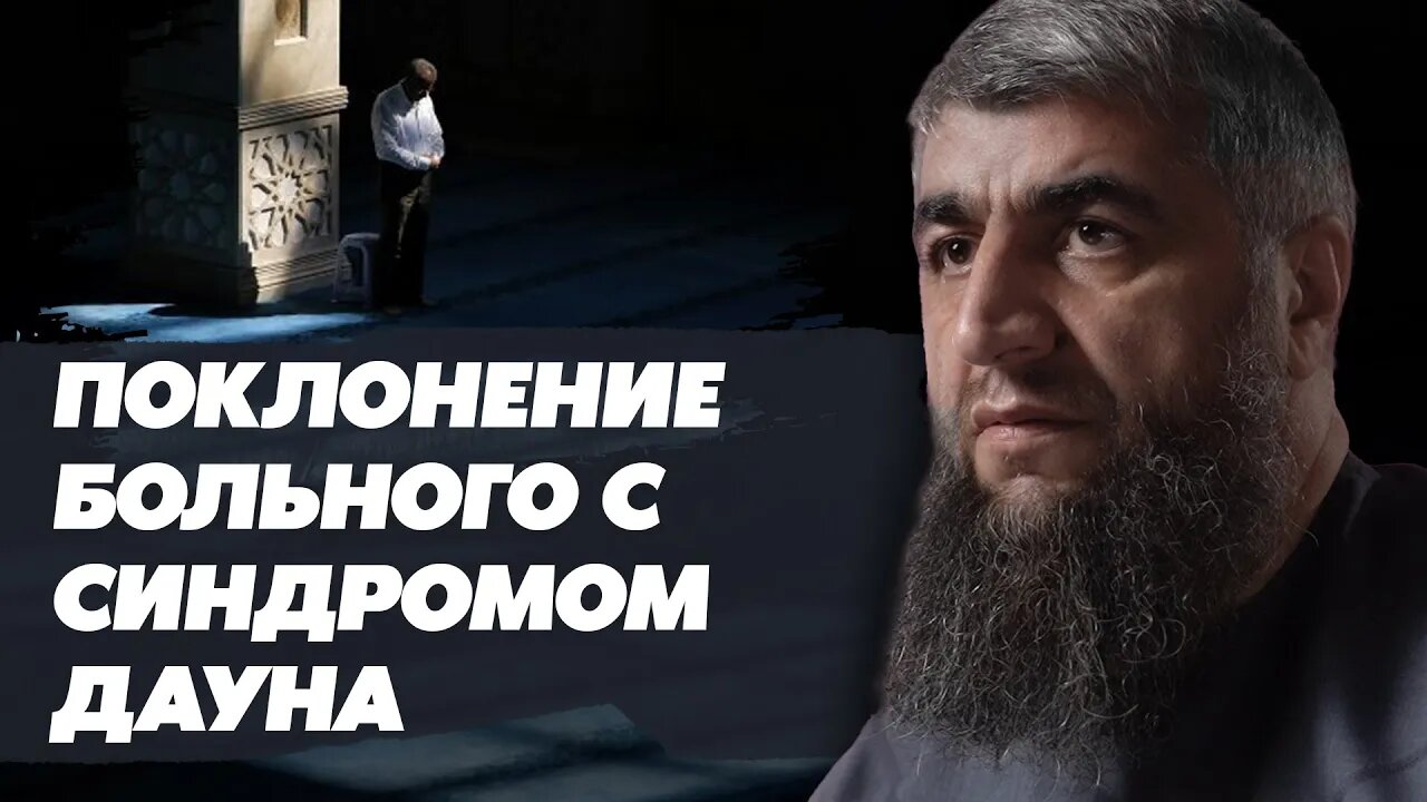 Поклонение больного синдромом дауна