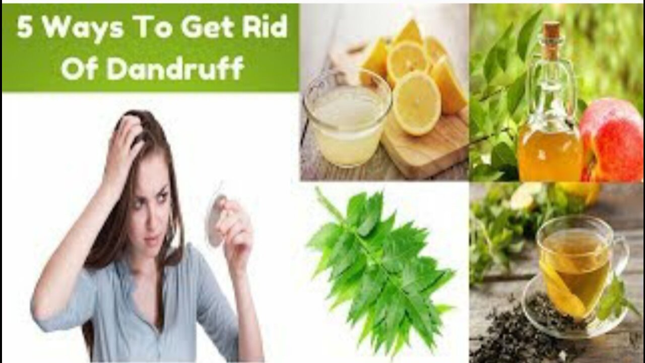 Get Rid of Dandruff With 5 Home Remedies-Cure And Control Dandruff Now.