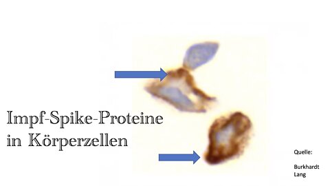 Die impfbedingte Entzündung des Gehirns - Encephalitis