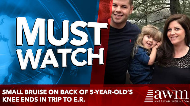 Small Bruise on Back of 5-Year-Old’s Knee Ends in Trip to E.R.