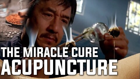 IS ACUPUNCTURE THE MIRACLE CURE FOR EVERYTHING? | ACUPRESSURE | NEEDLES | CHINA | MOXIBUSTION