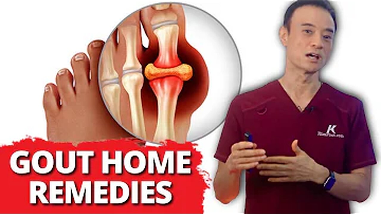 FAST RELIEF Home Remedies for Gout!