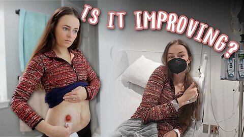 If It's SIBO, This Seems To Be Helping! | Let's Talk IBD