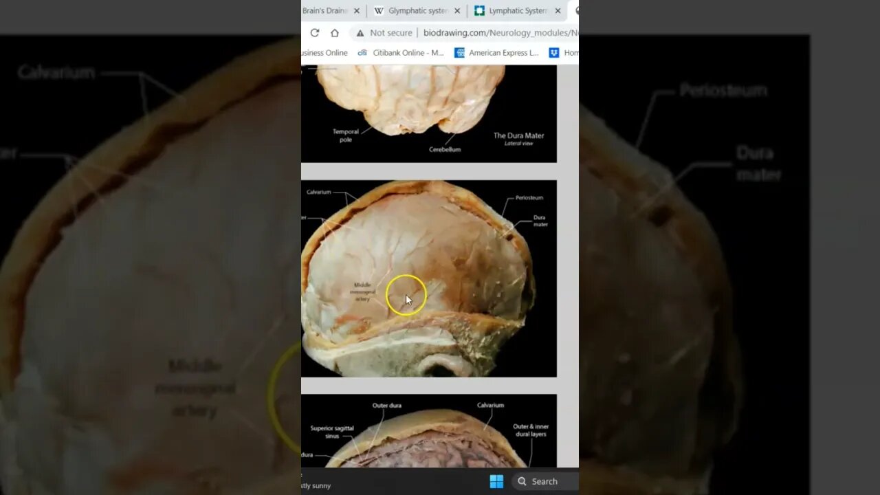 The Dural Connection
