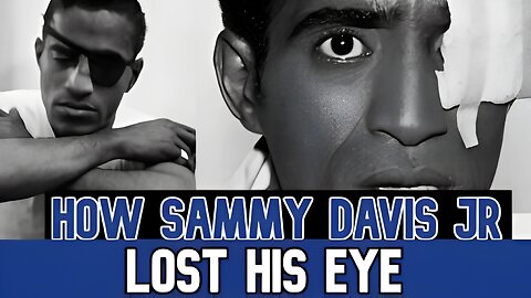 How Sammy Davis Jr. Lost His Eye – The Untold Triumph & Shocking True Story #sammydavisjr