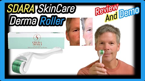 SDARA Skin Care Derma Roller Review After 6 Weeks of Microneedling