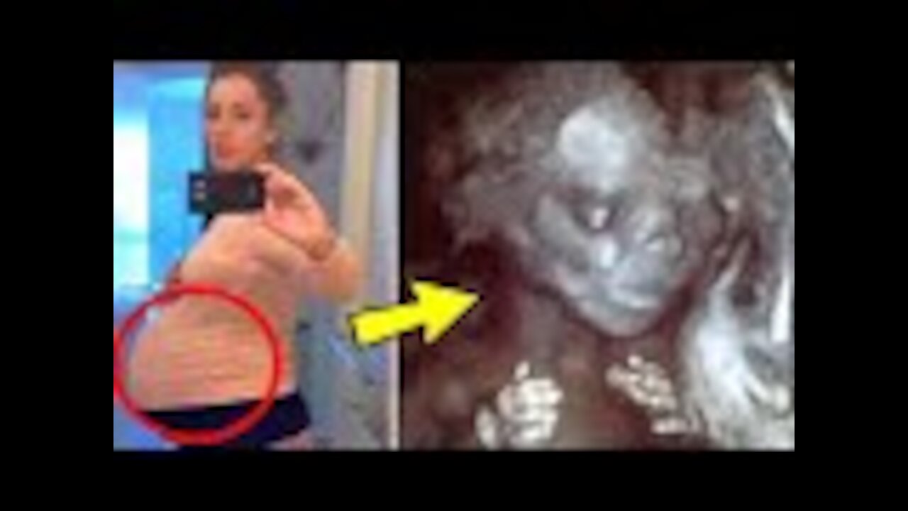 Young Surrogate Carries Couple’s Child, Then They Look Closer At The Scan And Freeze