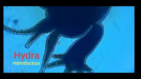 Hydra reproduction(Bud)