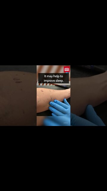 Surprising Benefits of Raw Honey.#shorts