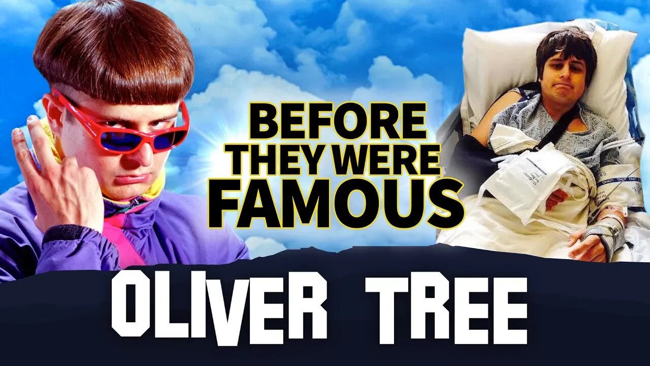 Oliver Tree | Before They Were Famous | From Meme God to Viral Musician