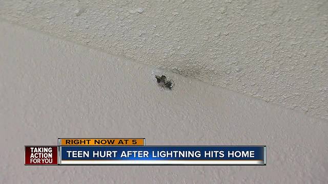 Teen develops rash after lightning strikes her Palm Harbor home