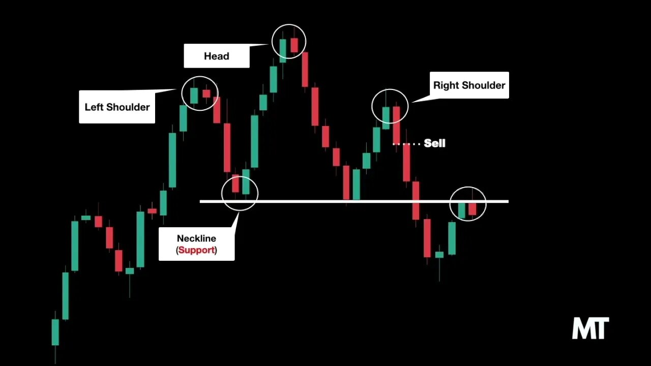 Head and Shoulders Chart Pattern | Part 1