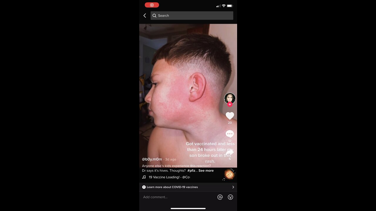 Kid with a reaction to the vaccine!!!🤦🏾‍♂️