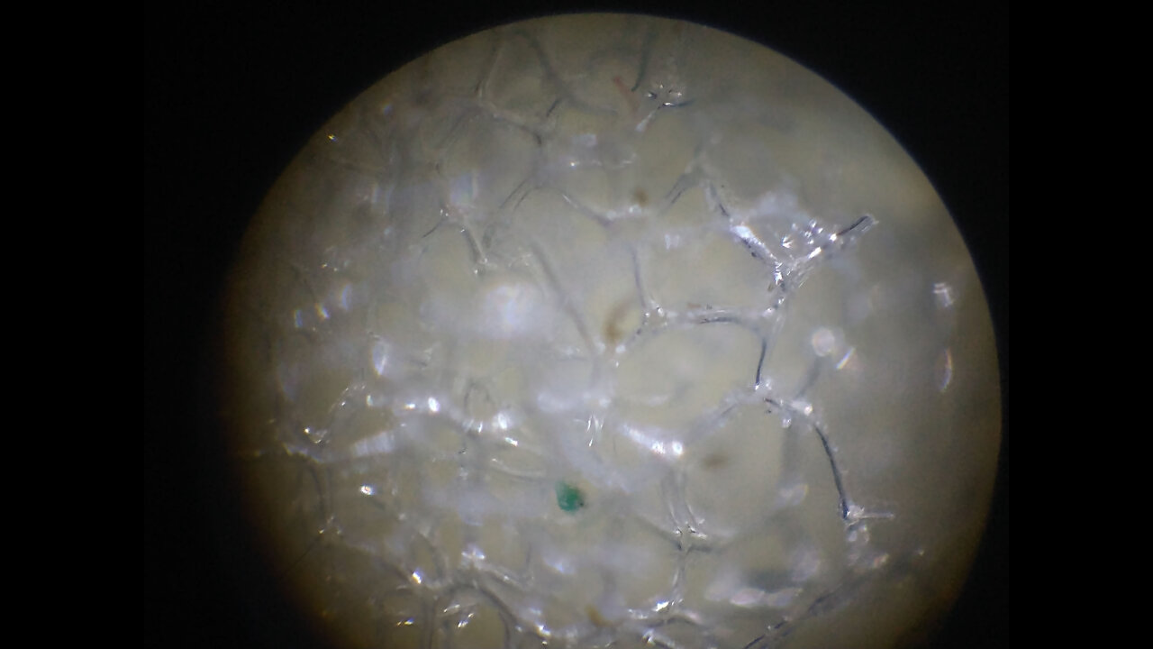 COVID-19 Test (Anomaly found under microscope) on test swab?