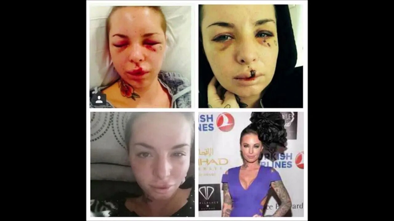 Men who support what War Machine did to Christy Mack, should be put in prison!