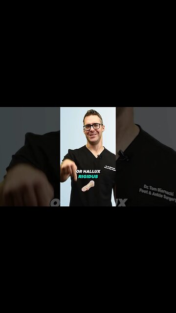 What is a Bunion or hammertoe? [Best Bunion Treatment]