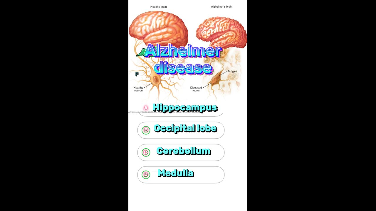 Alzheimer’s disease question answers MCQs : neurological disorder,#disease #mcqs #3dmedico 🧠👩🏻‍🦼