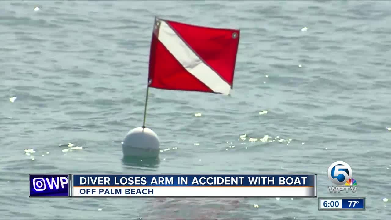 Diver loses an arm in accident with boat off Palm Beach