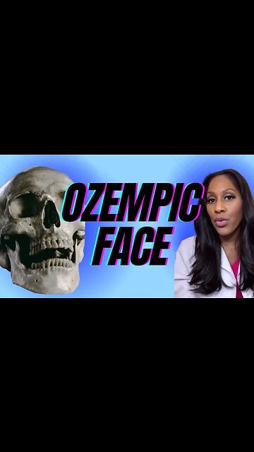 What is “Ozempic Face?” Is it Dangerous? A Doctor Explains