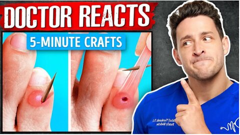 The Worst 5 Minute Crafts Health Hacks