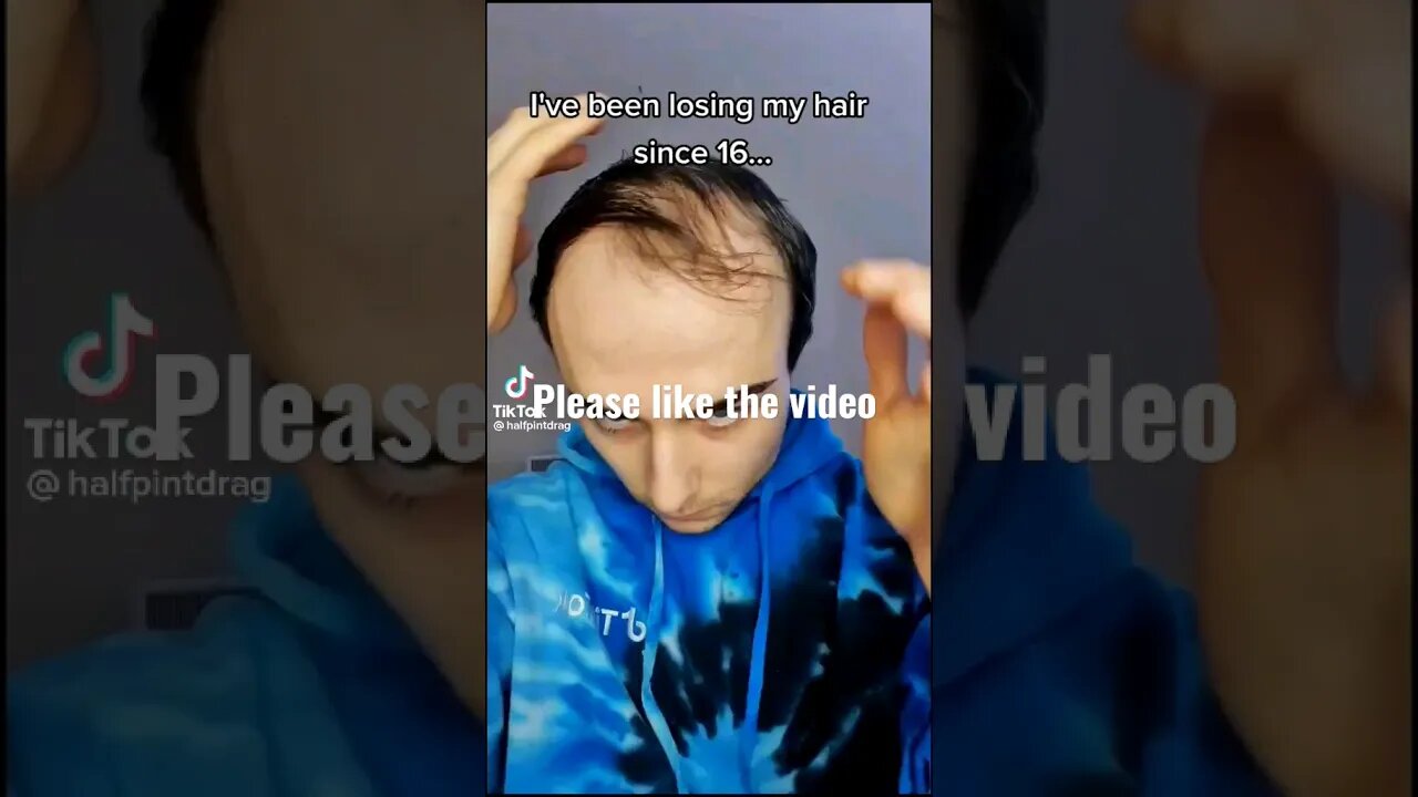 it is over for bald guy #blackpill