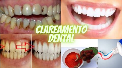 Receita indiana para clareamento dental