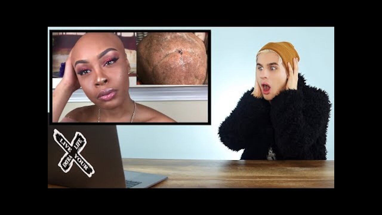 THIS WEEKS CRAZIEST VIRAL HAIR VIDEOS (balding from a weave?!) EP.2! |bradmondo