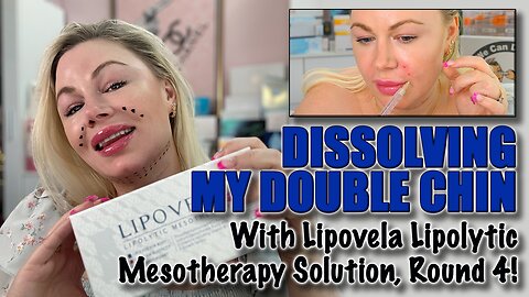 Dissolving my Double Chin with Lipovela: Round 4! Maypharm.net and Code Jessica10 saves you Money