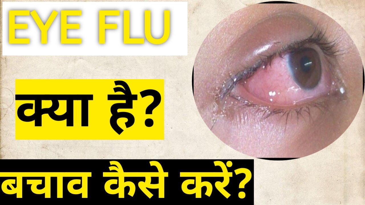 Eye flu kya hai