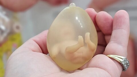 LIVE Womb Birth! World's Smallest Baby To Be Born!