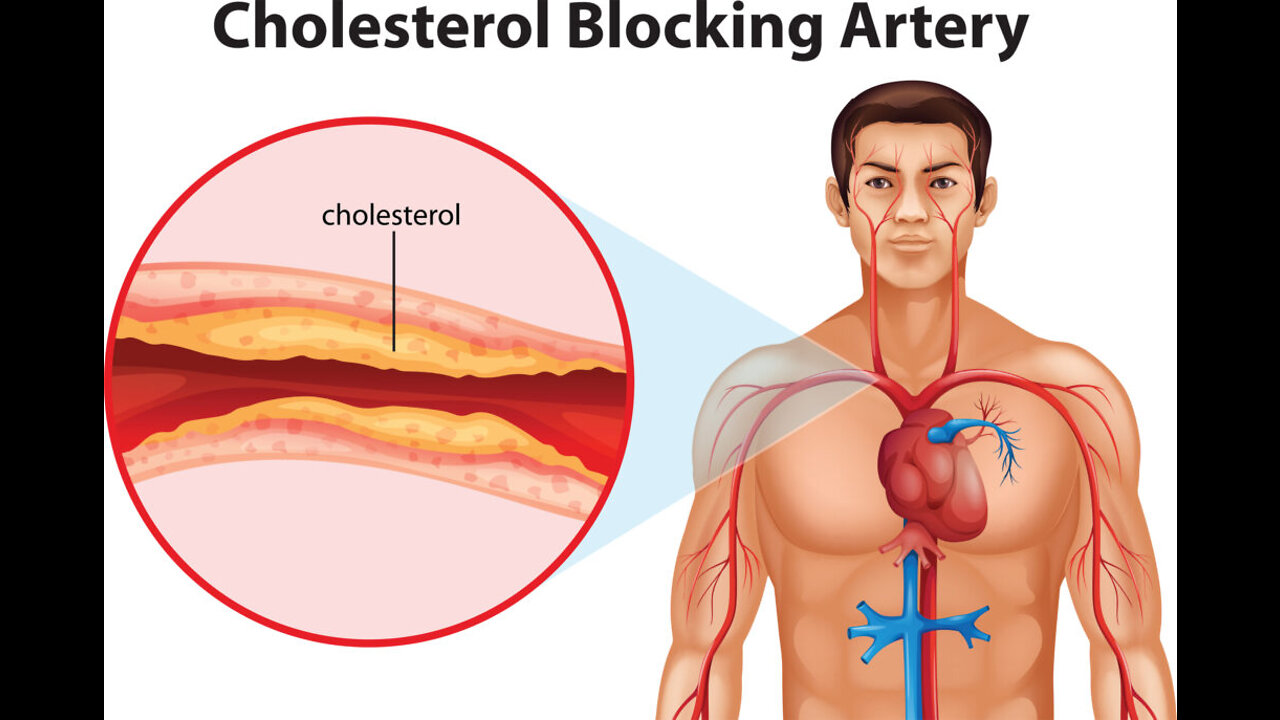 Would High LDL REALLY gives you a heart attack?