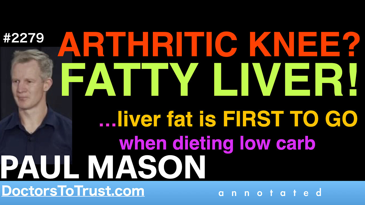 PAUL MASON o1 | ARTHRITIC KNEE? FATTY LIVER! …liver fat is FIRST TO GO when dieting low carb