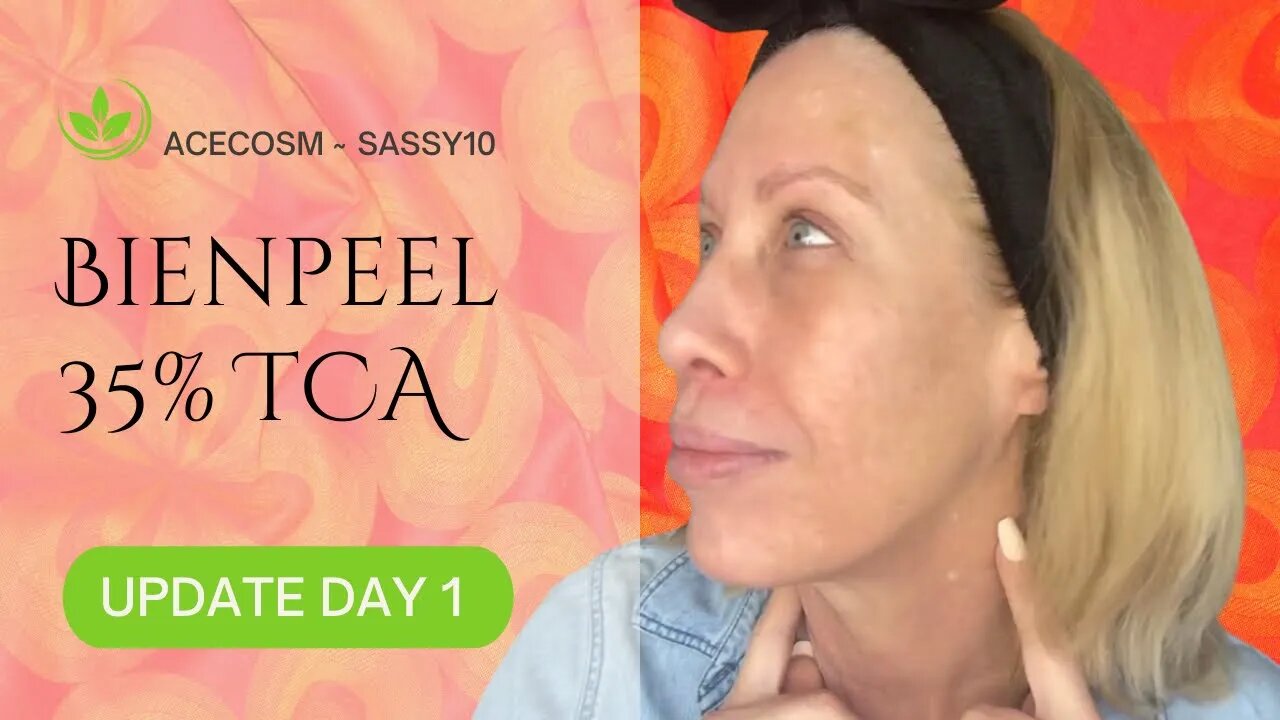 BienPeel 35% TCA 🥰 Day One Update AceCosm .com SASSY10