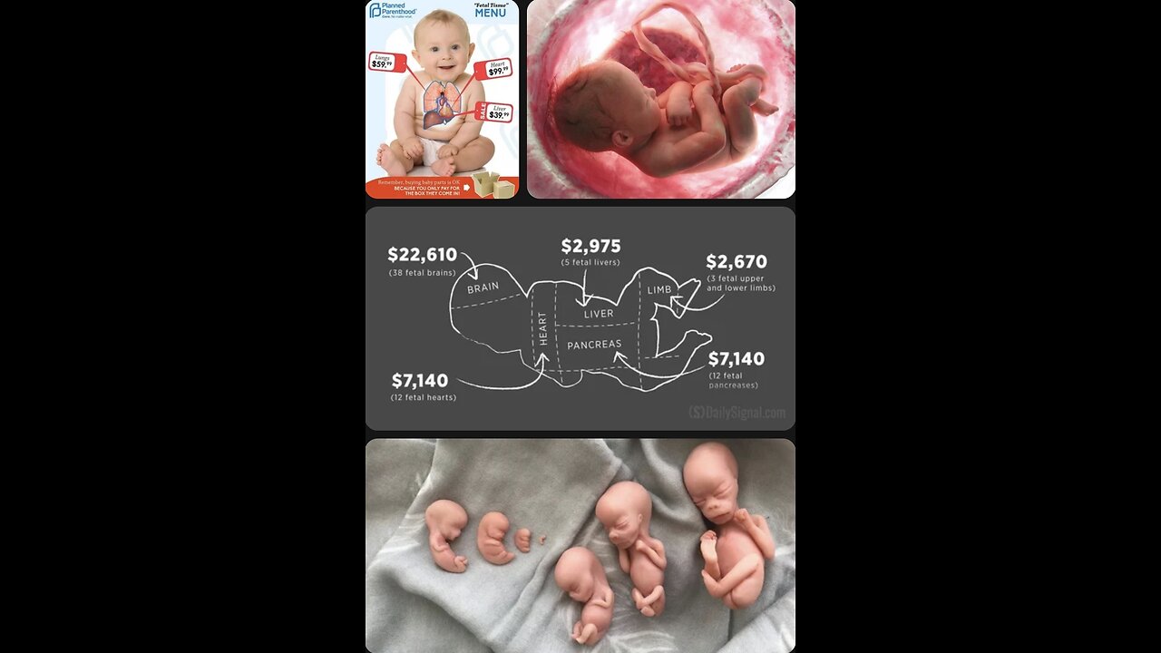 Babies are worth more dead than alive” - organ sales of aborted babies - Planned Parenthood