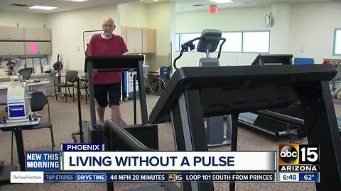 Valley man living without a pulse, thanks to LVAD heart pump