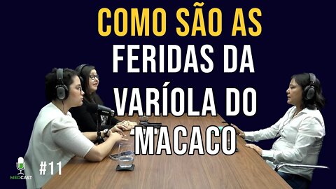 As feridas da varíola do macaco