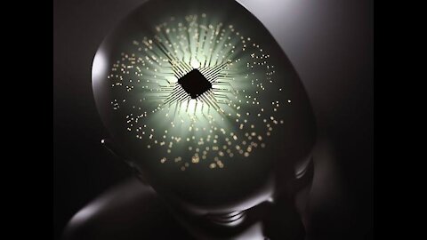 Implants