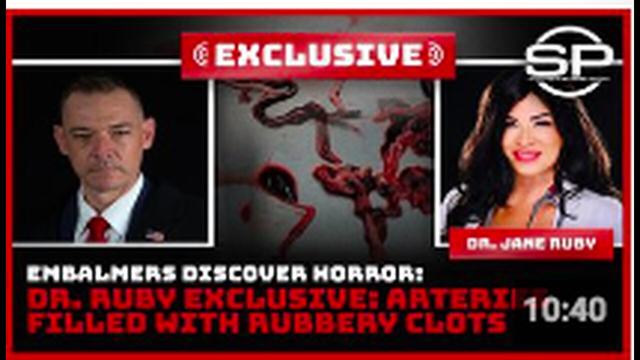 Embalmers Discover Horror: Dr. Ruby Exclusive: Arteries Filled With Rubbery Clots