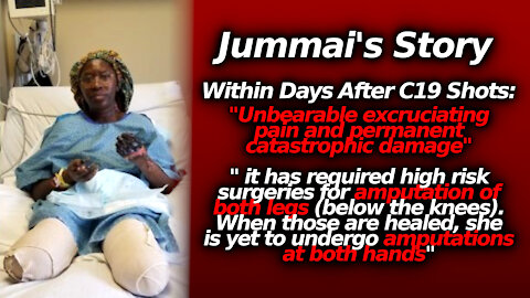 Jummai's Vax Nightmare: Double Leg Amputee & Will Lose Her Hands Too. All Right Vaccine!