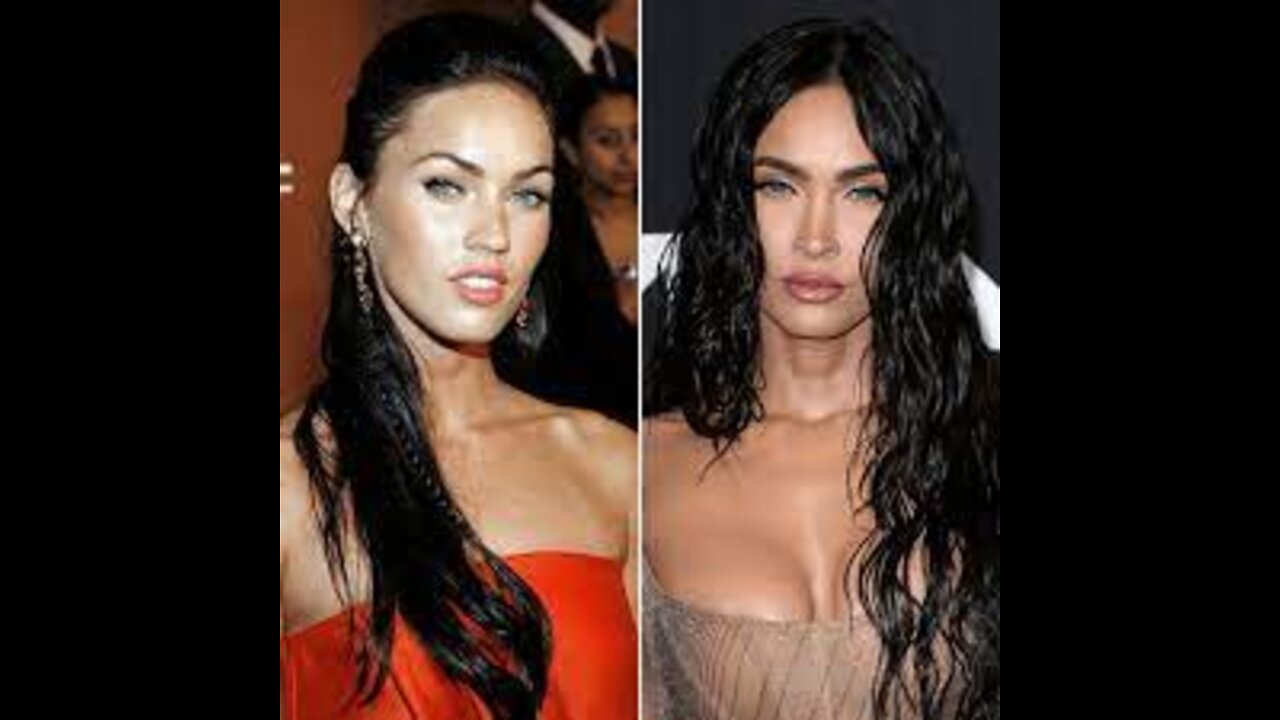 Megan Fox Before After Plastic Surgery Botox
