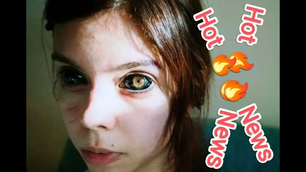 Tattooist's blunder saw woman have eyeball removed and left blind in the other
