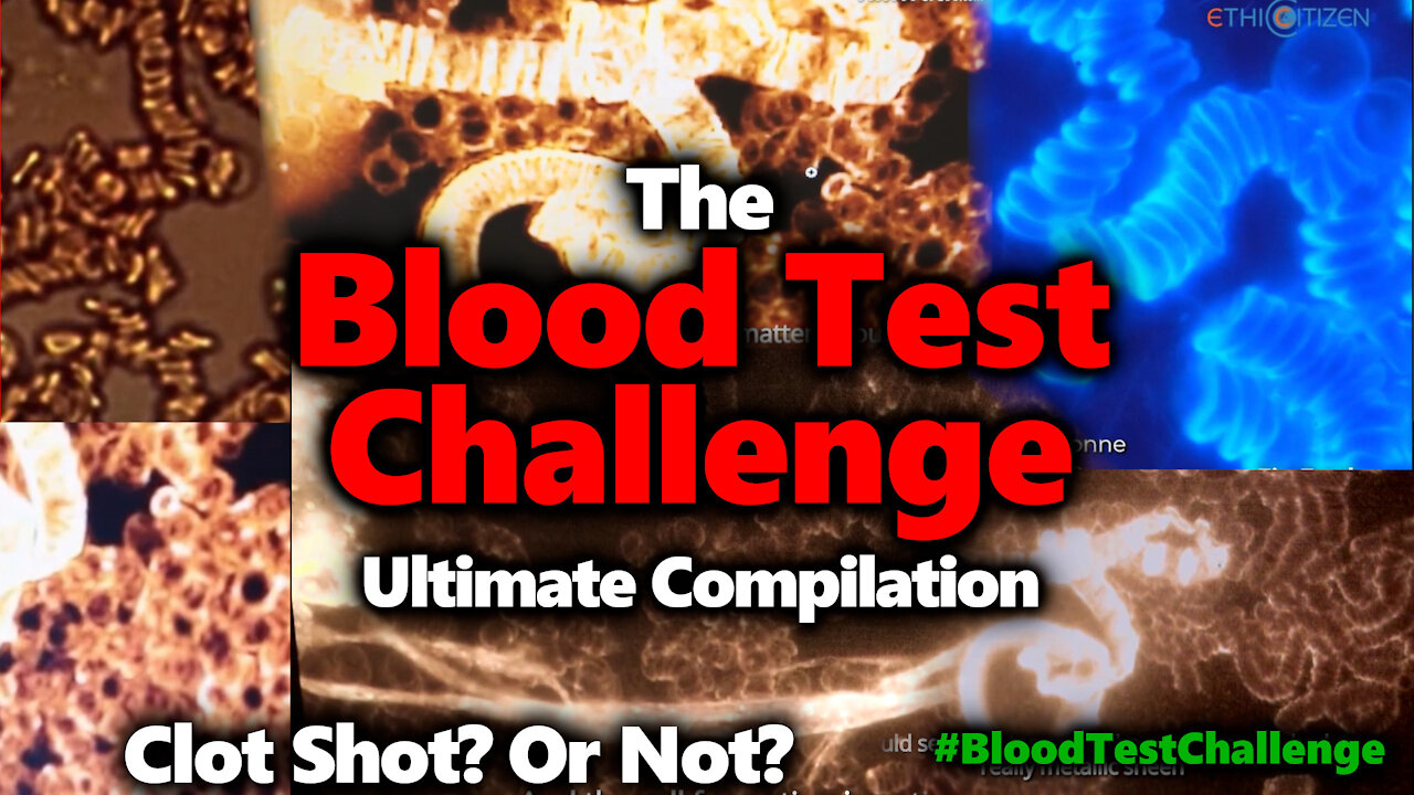 BLOOD TEST CHALLENGE:Blood Testing & The Vaccine, Is There Clotting? #ClotShot #BloodTestChallenge