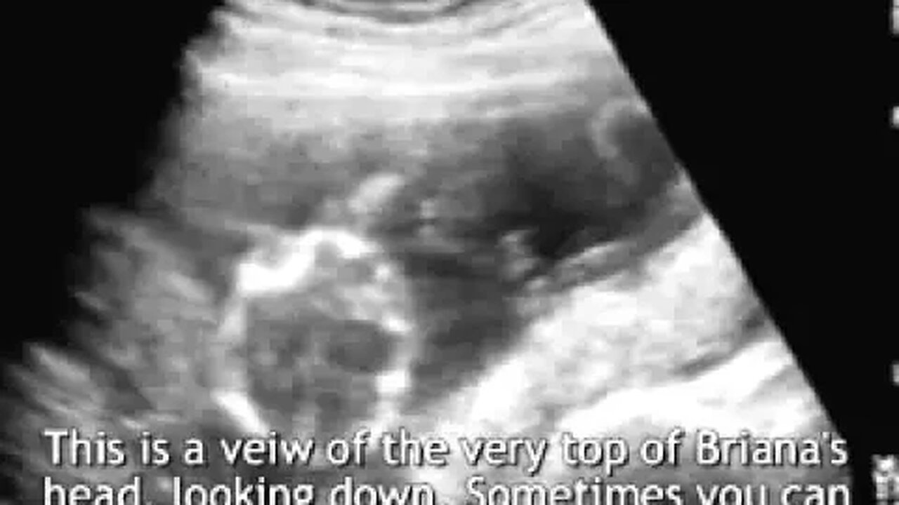 1994 6 Beanie in the Womb