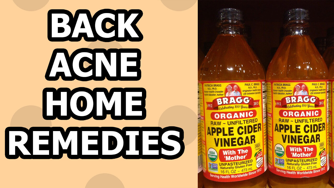 How To Get Rid Of Back Acne - 3 Home Remedies You Can Try Today!