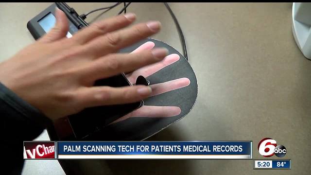 Palm scanning tech for patients' medical records