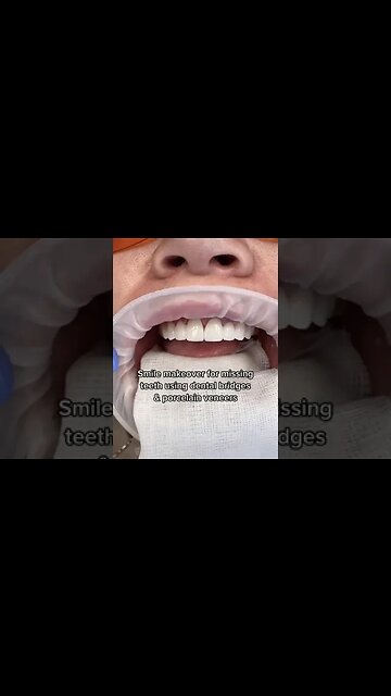 Dental And Teeth Hygiene