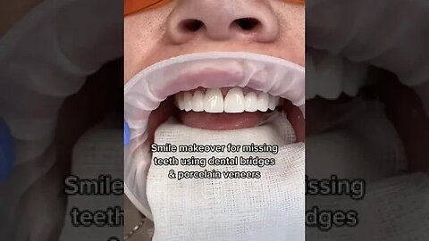 Dental And Teeth Hygiene